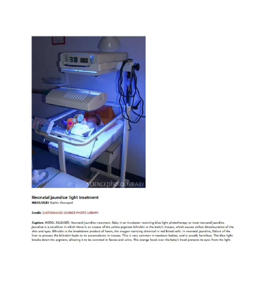 Dulux BLUE 9W 71 UVA Phototherapy Lamp Effective Jaundice Treatmen, Osram