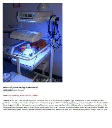 9W 52 2P UV-B PL-S Lamp - Medical Therapy for Jaundice 8222-18221